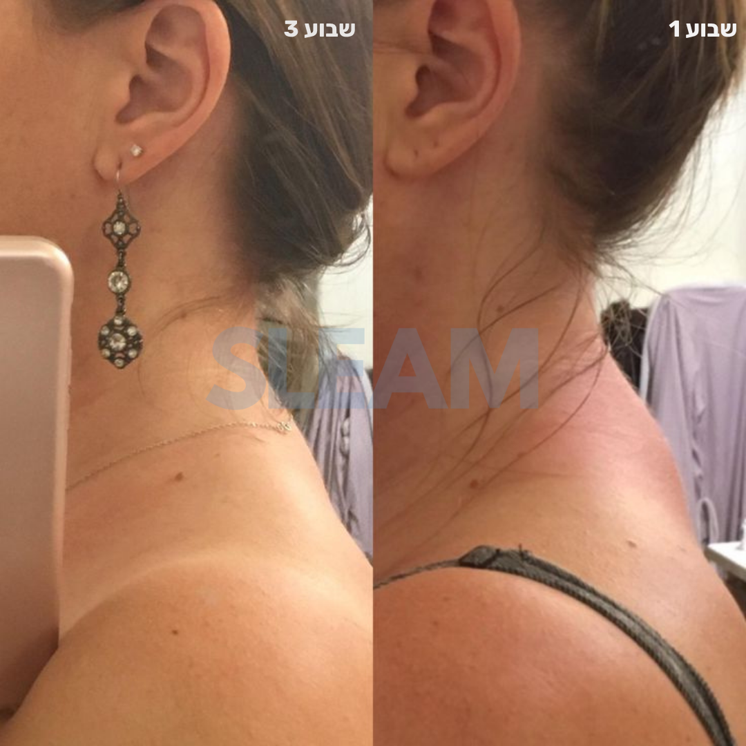 נק-מושן 360° מערכת שיקום צוואר ביתית שלמה Sleam