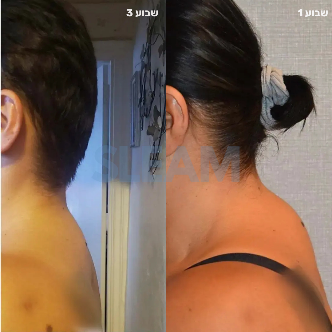 נק-מושן 360° מערכת שיקום צוואר ביתית שלמה Sleam